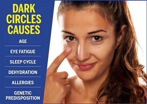 How To Get Rid Of Dark Circles At Home