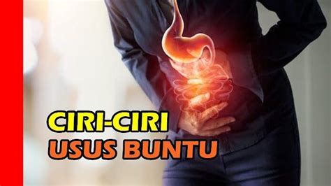 Ciri Ciri Usus Buntu Yang Harus Dioperasi Homecare