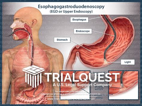 Esophagogastroduodenoscopy Anatomy