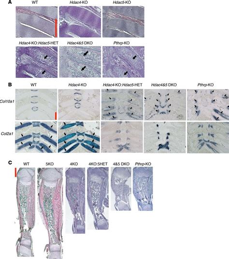 Identification Of Hdac As An Additional Mediator Of Pthrp Signaling