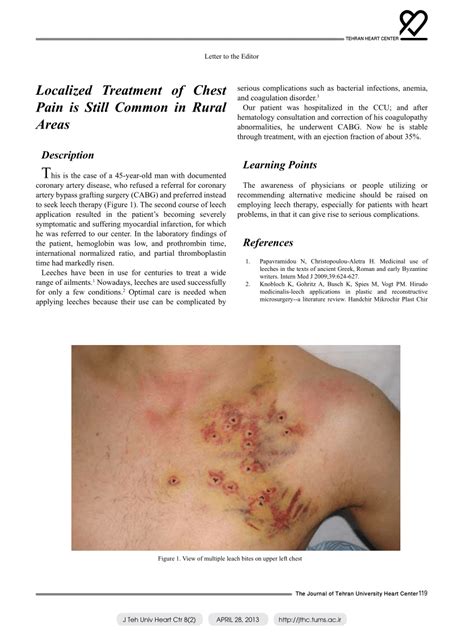 (PDF) Localized Treatment of Chest Pain is Still Common in Rural Areas