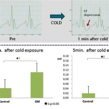 Changes of ST segment in ECG. Changes between ST segments before and ...