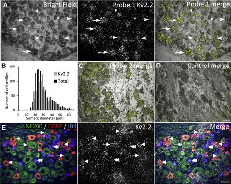 Kv2 2 MRNA Expression In Rat DRG Neurons A Bright Fi Eld And