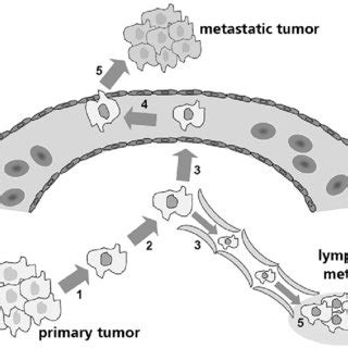 Molecular mechanism of metastasis. To produce a tumor metastasis tumor ...