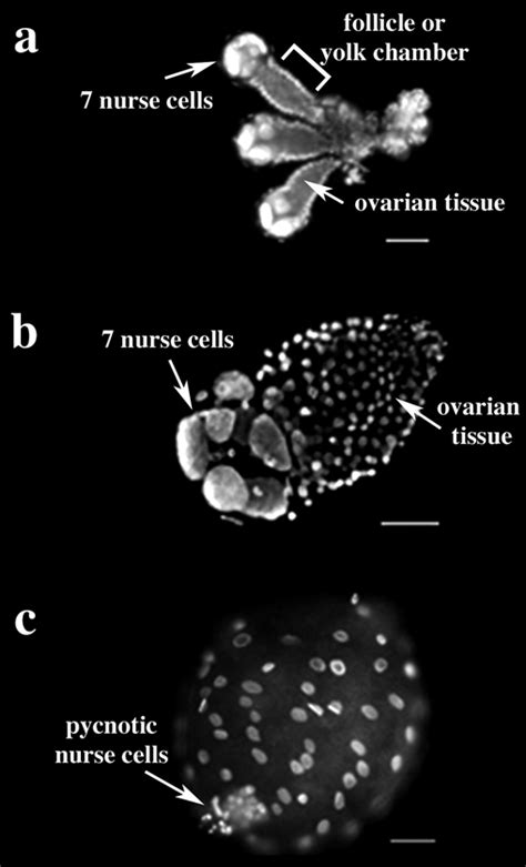 A C Stages Of Oogenesis In Planococcus Citri A Three Follicles Are Download Scientific Diagram