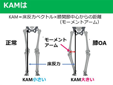 変形性膝関節症で着目すべき”kam”とは 整体院 安芸 Aki