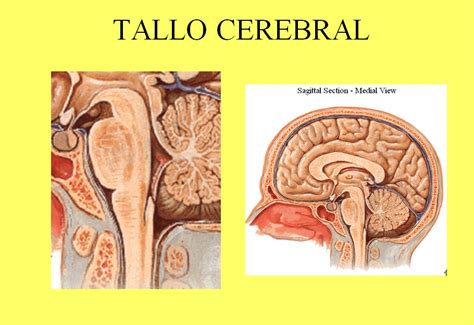 Educando Para El Mundo Tallo Cerebral