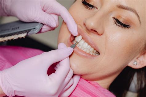 Veneer Teeth Shaving Dental Park