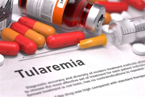 What Are The Causes Symptoms And Treatments Of Tularemia Facty Health