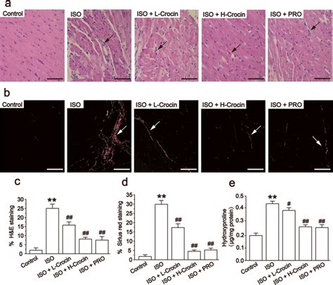 Effects Of Crocin On H E Staining A And C Sirius Red Staining B And