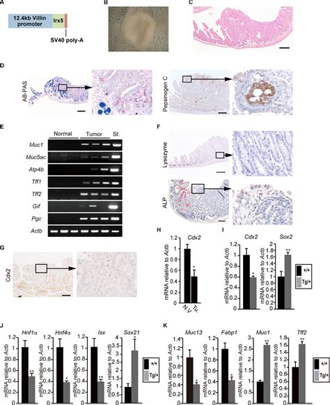 Heterotopic Irx5 Expression Leads To Development Of Gastric Tissue In