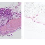 Histological Analysis Of Murine Calvaria Retrieved On Day After Pe