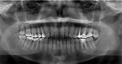 Radiografías dentales en Coronel al mejor precio