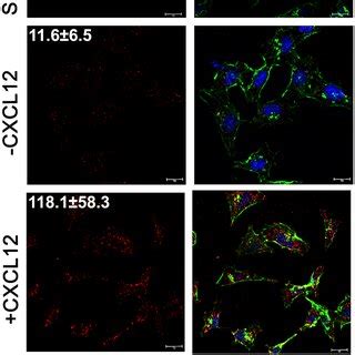 The Lasp Eif A Interaction Increases With Cxcl Stimulation In Situ