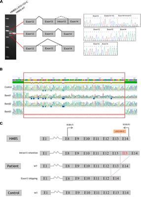 Frontiers Genetic Analysis Of Acute Intermittent Porphyria Caused By