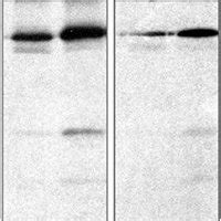 Structure Of Connective Tissue Growth Factor Ccn Isoforms And Their