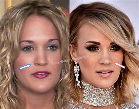 Carrie Underwood: BEFORE and AFTER