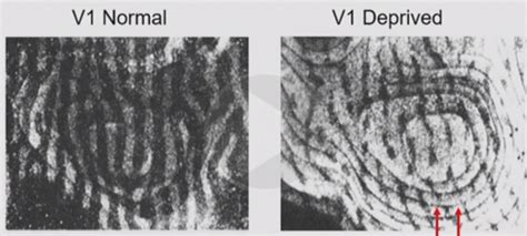 lec 11 Flashcards | Quizlet 