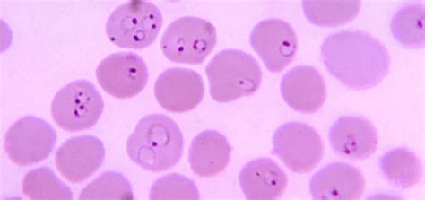 20+ Malaria Parasite PNG - Best Image