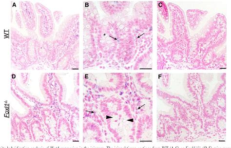 Figure From Foxl Deficient Mice Exhibit Aberrant Epithelial Cell