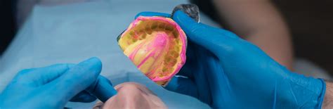 silicone dental impression material xjy silicones