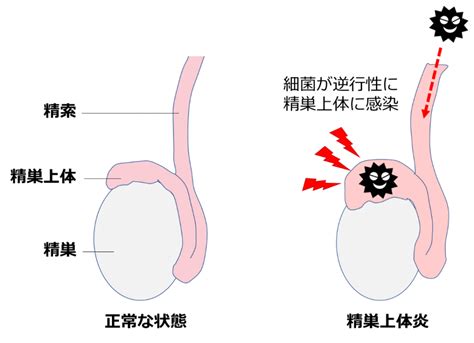 精巣の病気 志田泌尿器クリニック