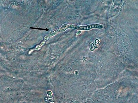 Fun With Microbiology (What's Buggin' You?): Trichophyton rubrum