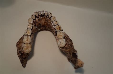 Chipped teeth suggests Homo naledi had a unique diet