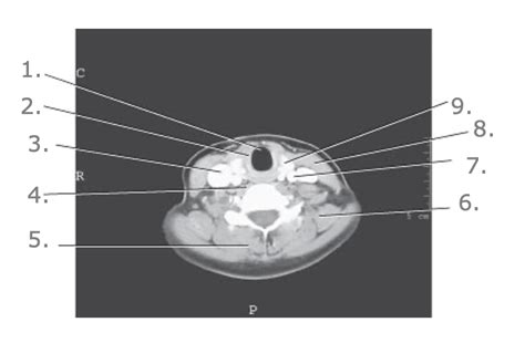 Rtt Neck Diagram Quizlet