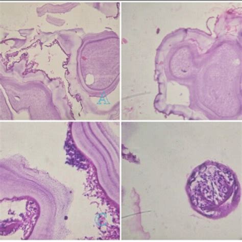 Microscopic examination using Haematoxylin & Eosin staining (A= 200X ...