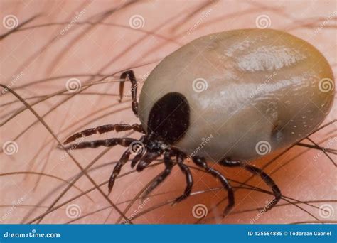 Tick On The Human Surface Skin Stock Image Image Of Nature Ixodes