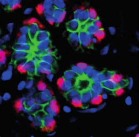 miRCURY LNA miRNA Detection Probes 
