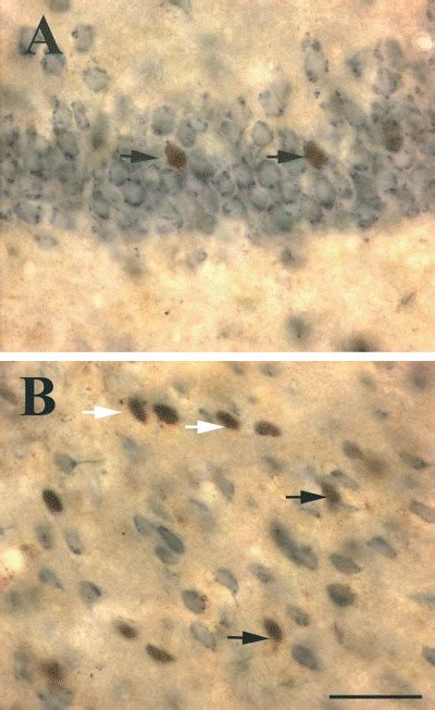 Brightfield Photomicrographs Depicting Dual Label Ihc For C Fos And