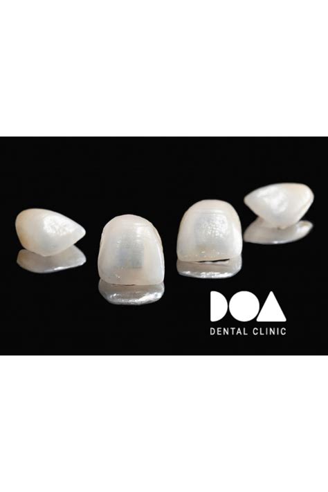 Qué es una corona dental DOA Dental Clinic