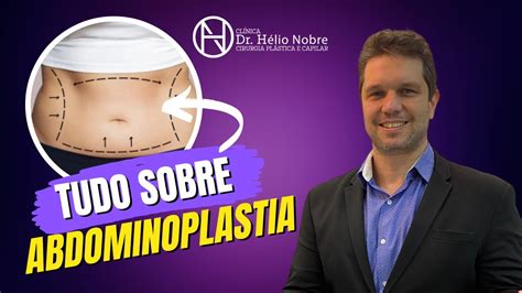 Tudo Sobre Abdominoplastia Dr H Lio Nobre Cirurgi O Pl Stico Youtube