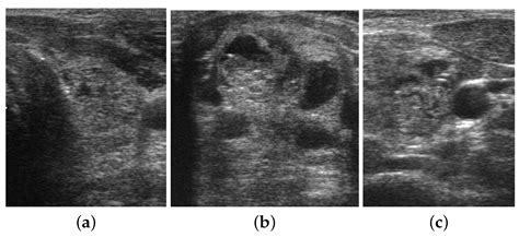 Diagnostics Free Full Text A Deep Learning Framework For The Characterization Of Thyroid