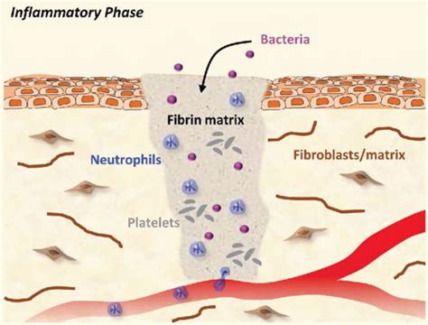 Wound Healing Normal And Abnormal Plastic Surgery Key