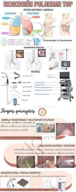 Infografías uDocz