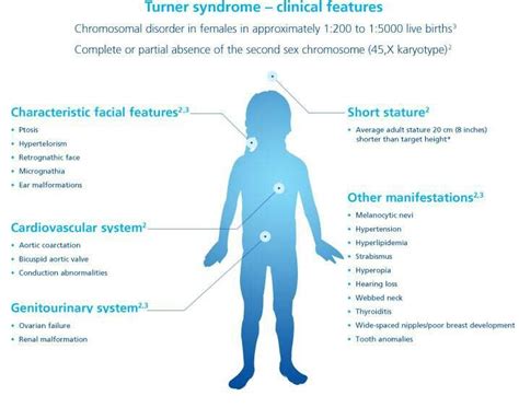 Turner Syndrome Chromosomes