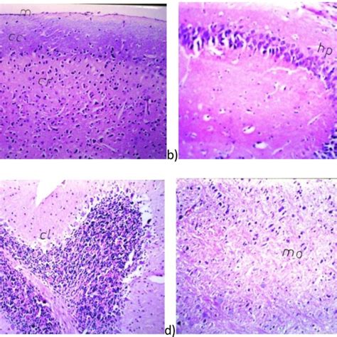 Histopathology of brain specimens from mice in which seizures were ... 