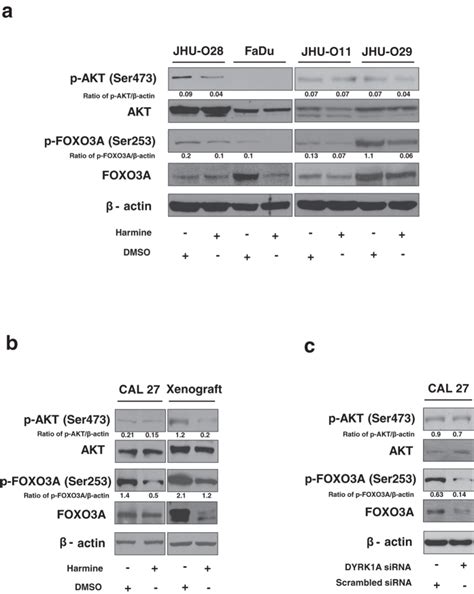 A dual specificity kinase, DYRK1A, as a potential therapeutic target ... 