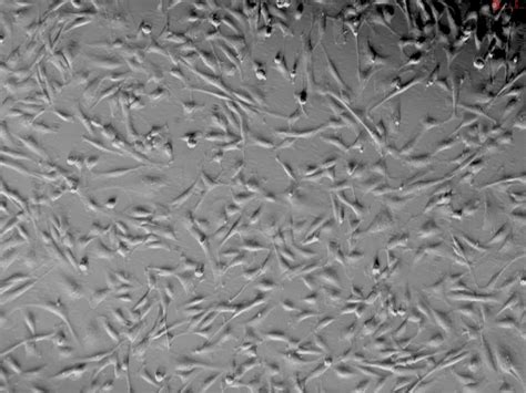 Human Pulmonary Artery Smooth Muscle Cells Hpasmc