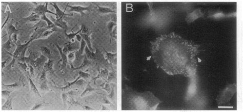 Figure From The Adhesive And Migratory Effects Of Osteopontin Are