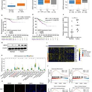 Inhibition Of Ubc Represses Prostate Tumor Growth Synergistically With