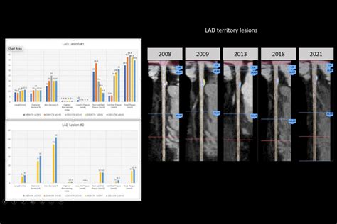 Coronary Calcium Score Test: What Does CAC Test Mean?