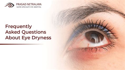 Frequently Asked Questions About Eye Dryness