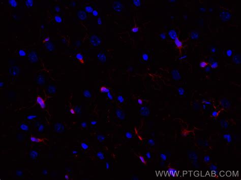 iba antibody cl  proteintech
