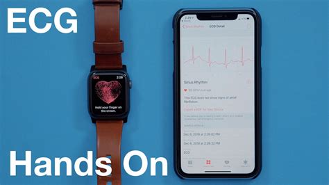 Hands-On With the ECG Feature for Apple Watch Series 4 - MacRumors