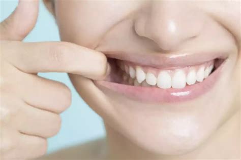 Tips For Preventing Unhealthy Gums