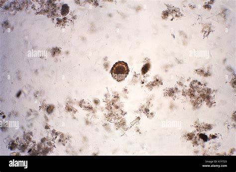 Fertile Ascaris Lumbricoides Hi Res Stock Photography And Images Alamy